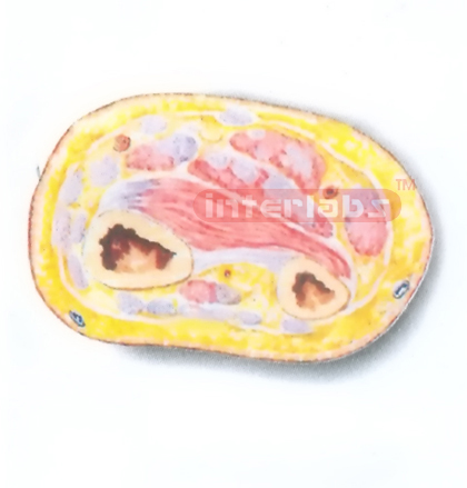 HUMAN TRANSVERSE SECTION MODEL THROUGH THE DISTAL 1/3 OF RIGHT FOREARM (C)